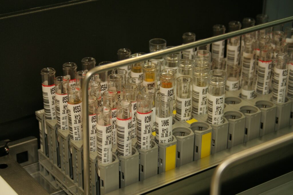 Immune tests - IVF Immunology
